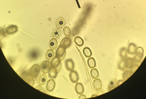 Ascospores of Genea hispidula.